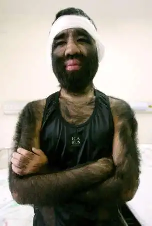 Самый волосатый человек в Китае