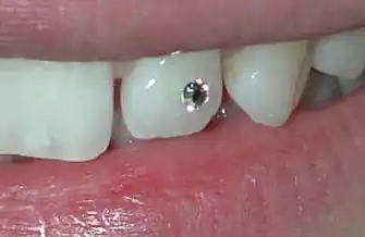 Бриллианты, навязшие в зубах