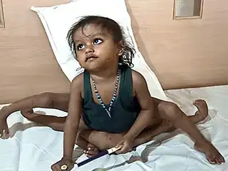 Индийская девочка Лакшми,родившаяся с восьмью конечностями, быстро идет на поправку, сообщили врачи