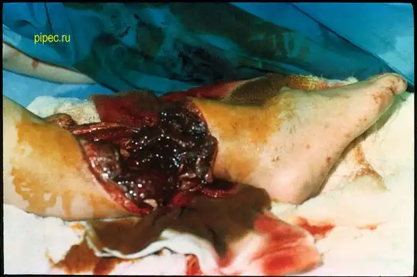 Берегите себя и своих близких