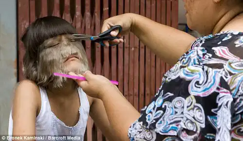 Самая волосатая девочка в мире (16 фото)