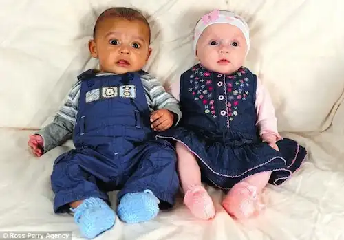 В Британии снова родились близнецы с разным цветом кожи