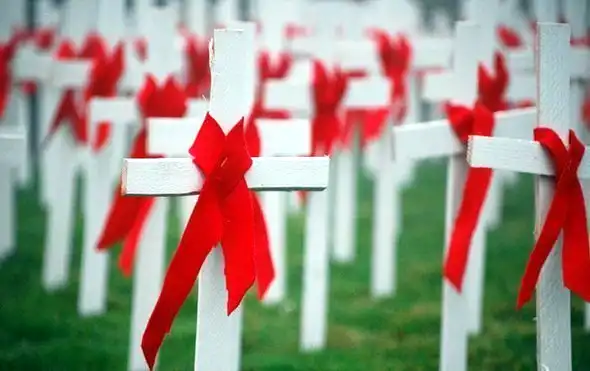 ВИЧ/ СПИД. Знаменитости, погибшие от СПИДа
