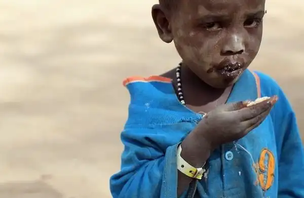 Голод в Сомали.