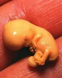 После аборта ребенок остался жив!