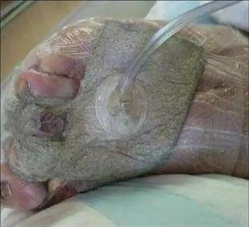 Не наступайте на осколки энергосберегающей лампочки.