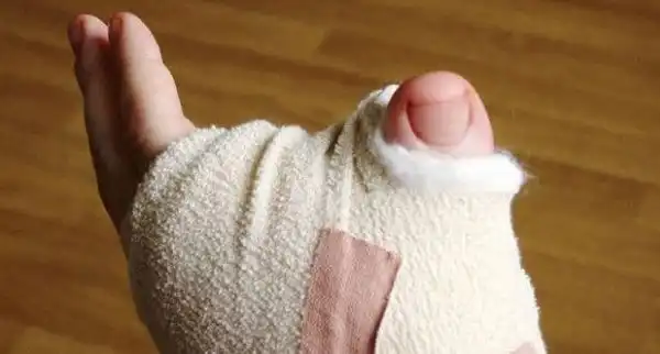 Палец ноги на руке