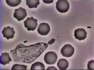 Лейкоцит гонится за бактерией