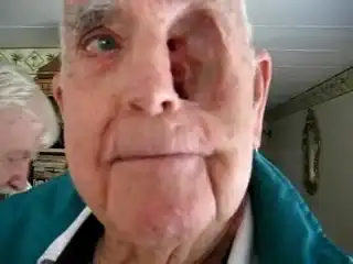 Мужик без глаза...