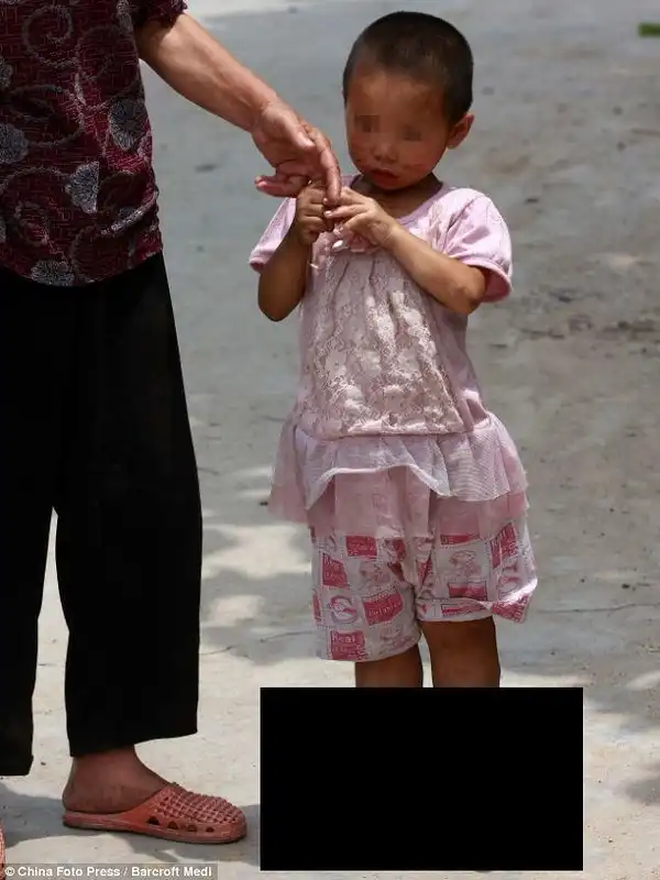 3-х летняя китаянка не может носить обувь
