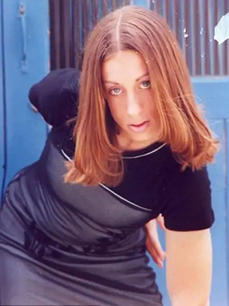 Как изменилась девушка после пластических операций