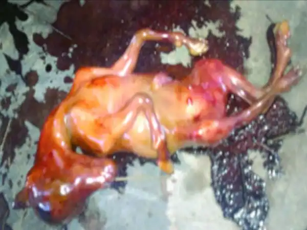 В Нигерии женщина родила мутанта, похожего на козленка