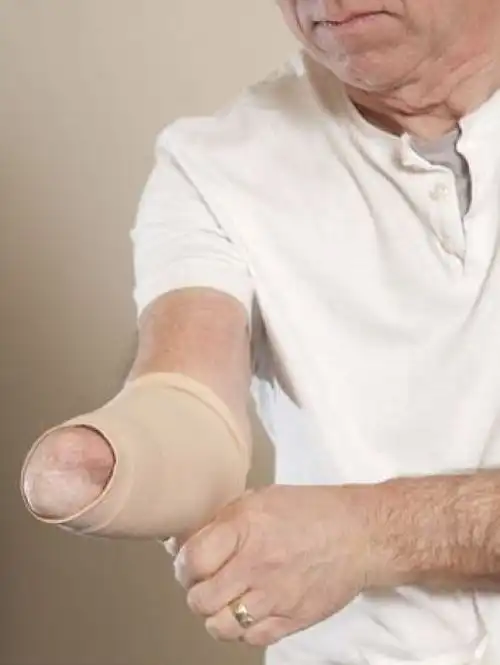 Бионические конечности способны заменить поврежденные руки и ноги