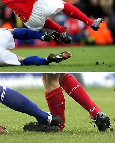 Самые ужасные травмы в истории футбола.