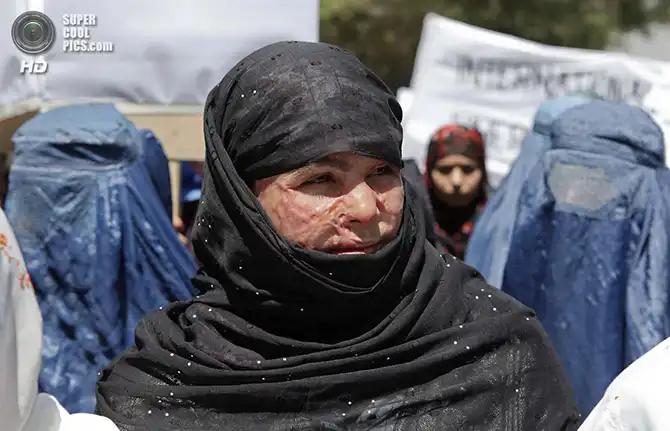 Женщины войны в Афганистане