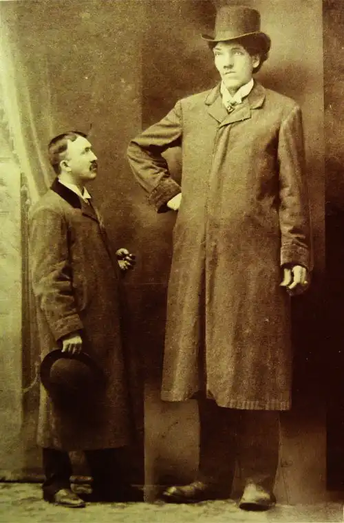 Эдуард Бопре - большой человек при жизни, рекламный щит после смерти