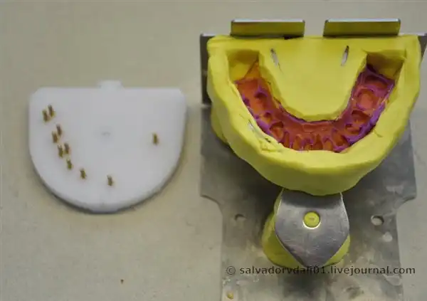 Как делают зубные коронки