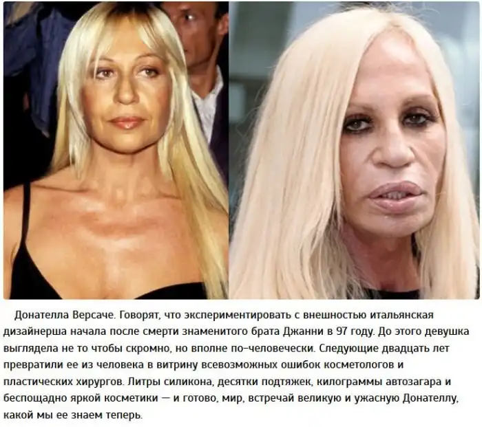 Знаменитости в погоне за красотой