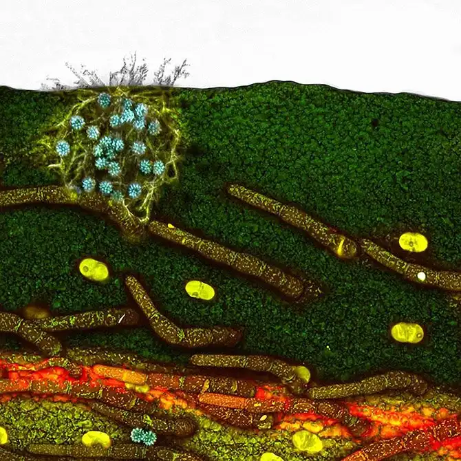 20 фотографий победителей Nikon Small World Photomicrography Competition