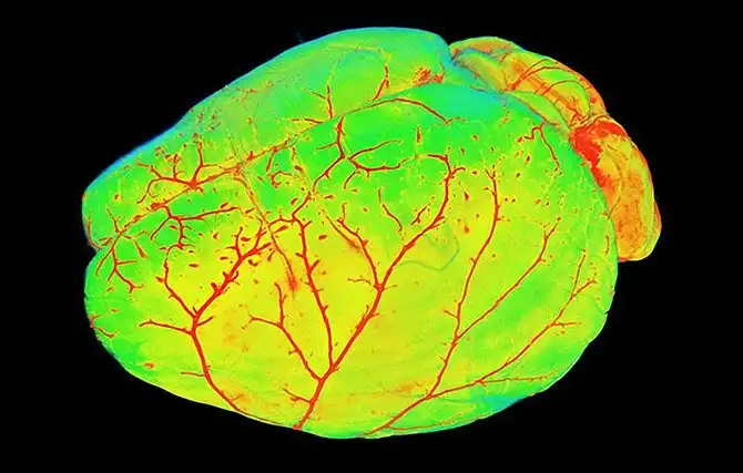 20 фотографий победителей Nikon Small World Photomicrography Competition