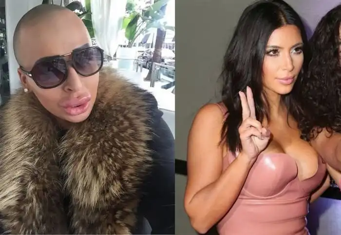 Парень потратил 100 000 фунтов, чтобы быть похожим на Ким Кардашян