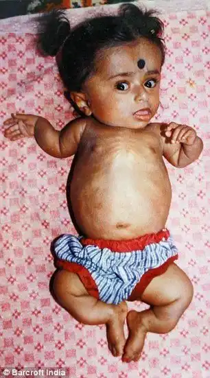 Детство навсегда: 19-летняя девушка, застрявшая в теле 2-летней девочки