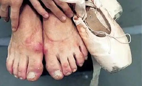 Как выглядят ноги профессиональных балерин