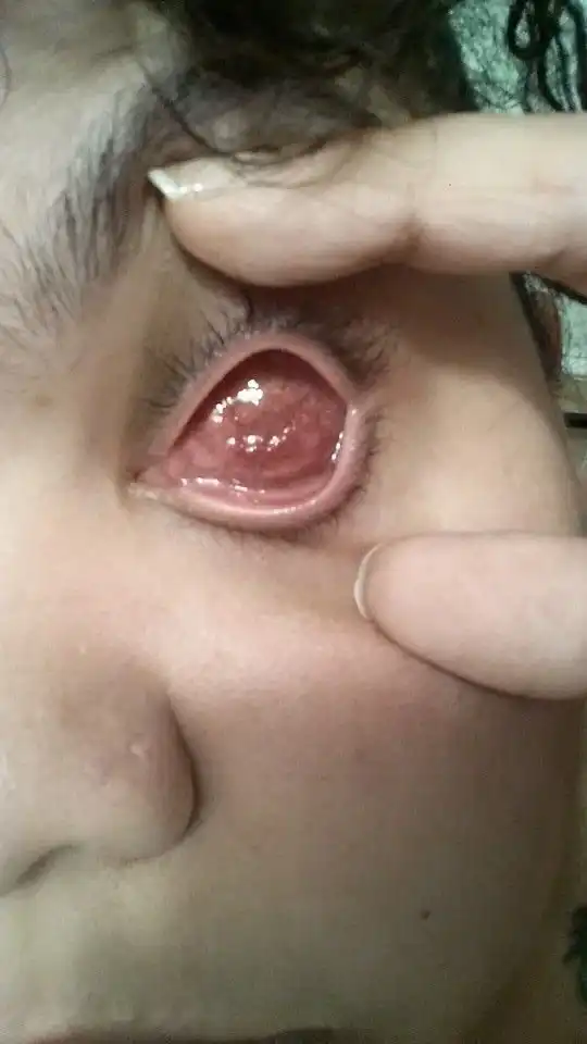 Одна блестка попала девушке в глаз