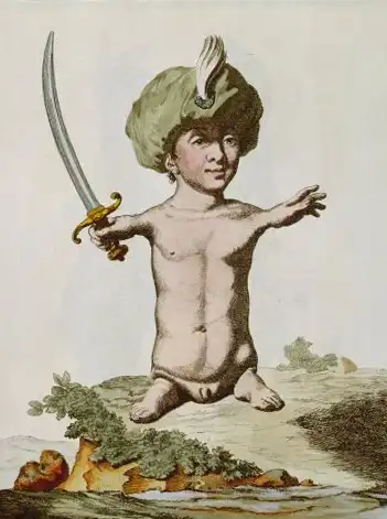 Люди-торсы: как им живётся (жилось) без рук и ног?