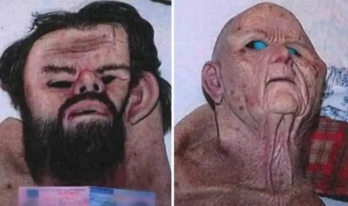 В Швеции врач-терапевт похитил девушку и сделал ее своей секс-рабыней