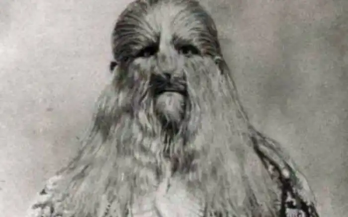 Йети – неизвестный науке вид или болезнь