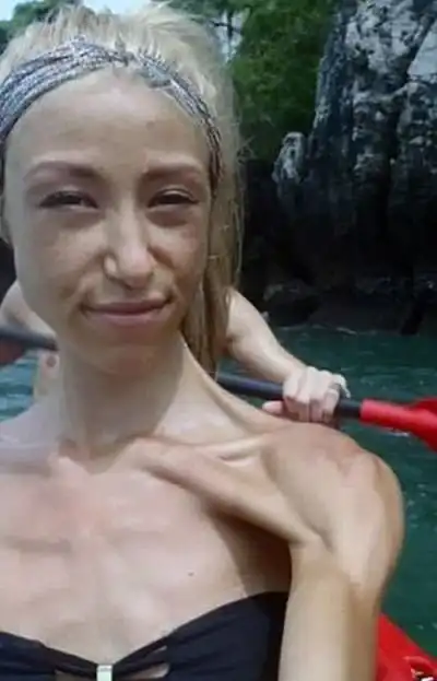 Девушка победила анорексию с помощью бодибилдинга