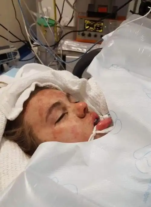 Юная девушка после приема таблеток экстази