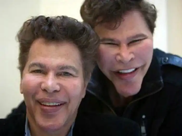 Жертвы пластической хирургии: близнецы Богдановы, которые уже не могут остановиться