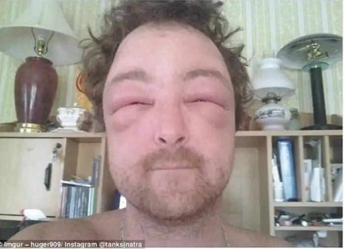 Лето: обратная сторона