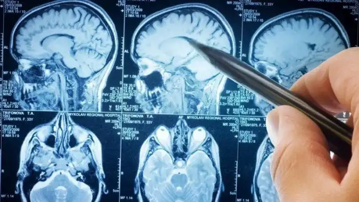 Нет никакого «я». Есть только наш мозг и его собственный взгляд на этот мир