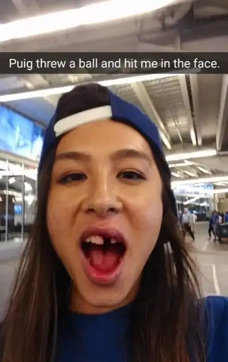 Чем опасен поход на бейсбольный матч для болельщиков