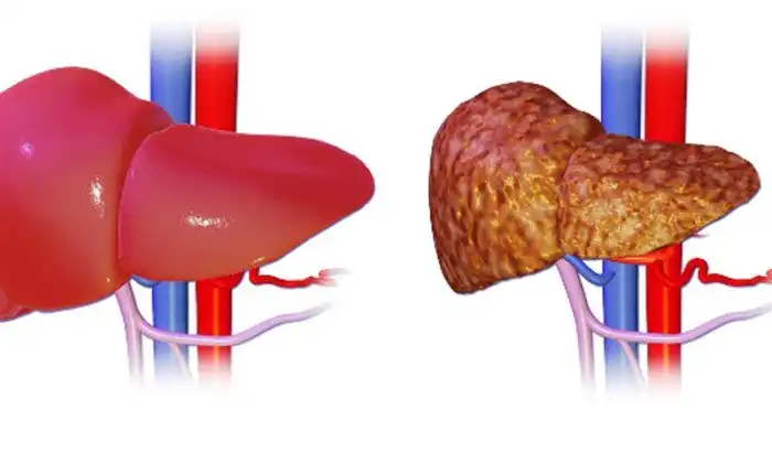 Важные факты о холестерине