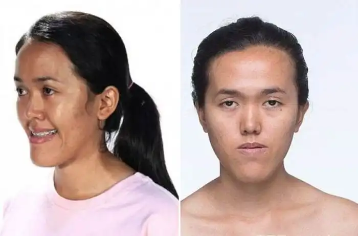 Чудеса современной пластической хирургии