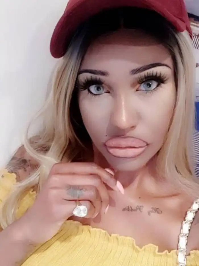 Рот на пол-лица: звезды, которые переборщили с инъекциями в губы