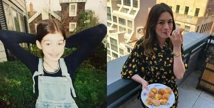 Как выглядели 20 знаменитостей до того, как о них узнали миллионы