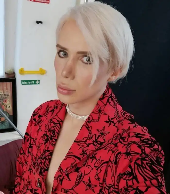 На кого они стали похожи после тысяч долларов, потраченных на пластику