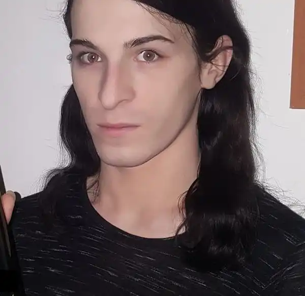 Парень лишился зубов из-за пристрастия к энергетикам