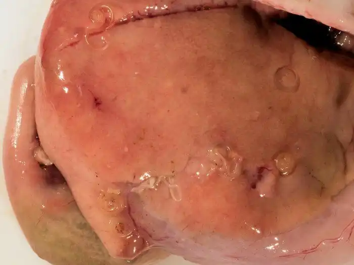 Суши: меню паразитолога