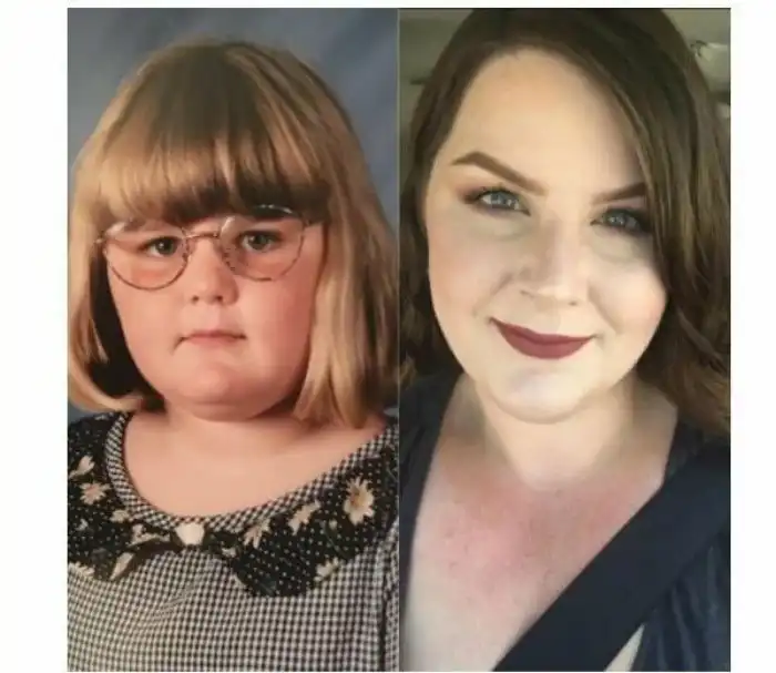 Из гадкого утенка в прекрасного лебедя: фотографии невероятных преображений