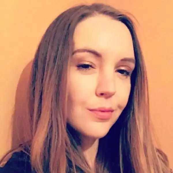 Девушка лишилась лба из-за привычки забрасывать ноги на приборную панель