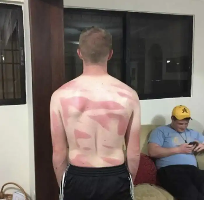 15 человек, которые не умеют пользоваться солнцезащитным средством