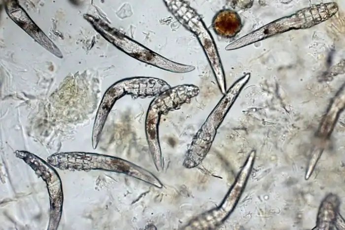 Эти крошечные клещи живут на вашем лице