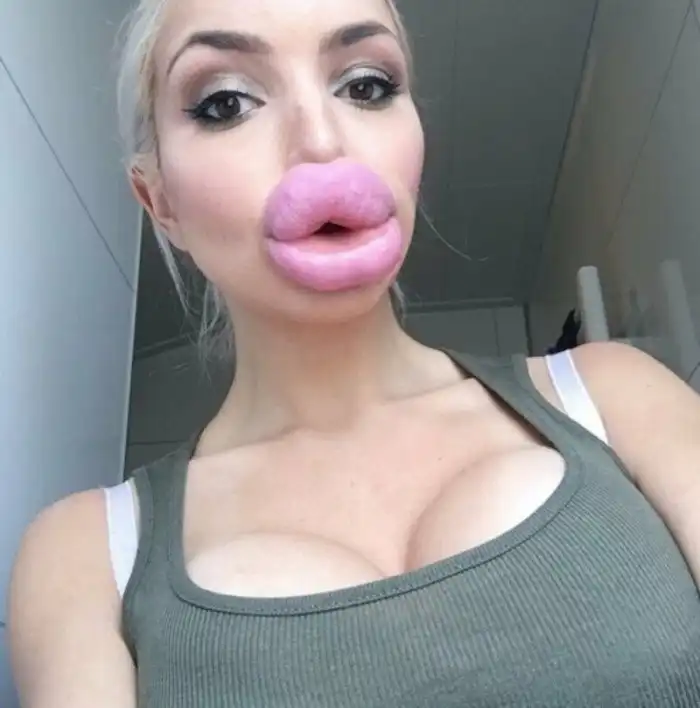 Бабьи накачанные губы и мужские мысли на эту тему