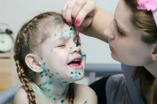 Почему практически нигде, кроме бывших республик СССР, не применяют зелёнку?